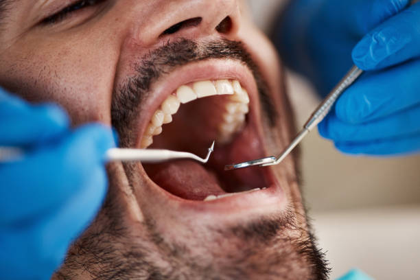 Best Cosmetic Dentistry  in Glenville, WV